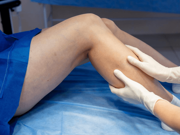 im1-Medicina y Cirugía Vascular y Angiología.png